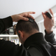 Image for article titled And Now A Man With A Camera Implanted In His Head